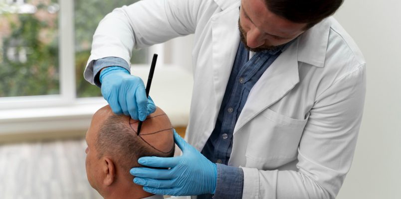 Dermatology-And-Hair-Transplant